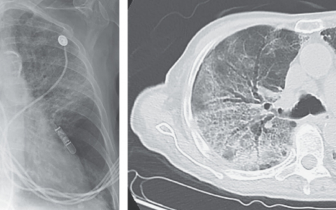 每日一题_2023.08.04
