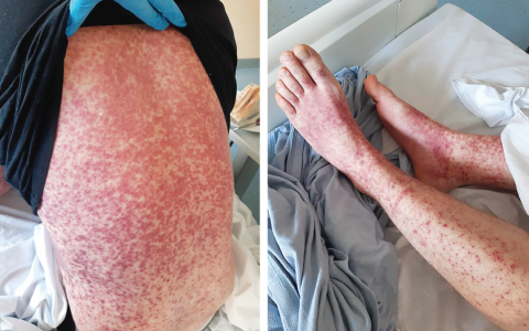 每日一题_2023.08.17