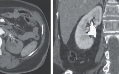 每日一题_2023.08.24