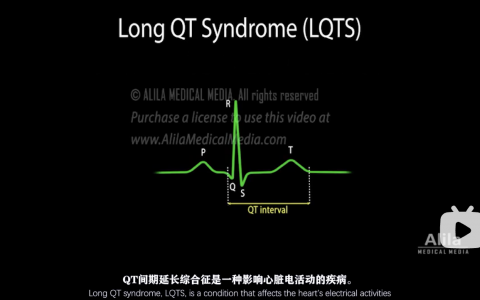QT间期延长综合征和尖端扭转型室性心动过速