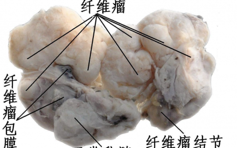 每日一题_2023.09.15