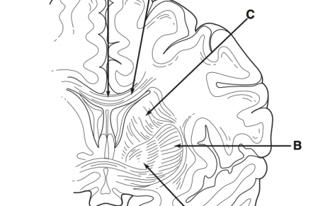 每日一题_2023.09.20