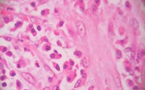 每日一题_2023.09.06