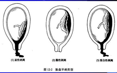 每日一题_2023.09.27