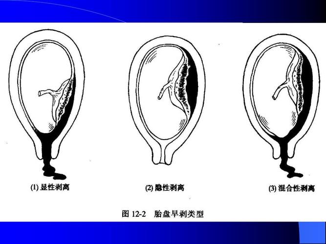 每日一题_2023.09.27