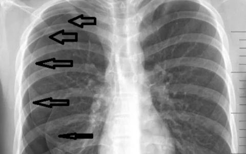 每日一题_2023.09.18
