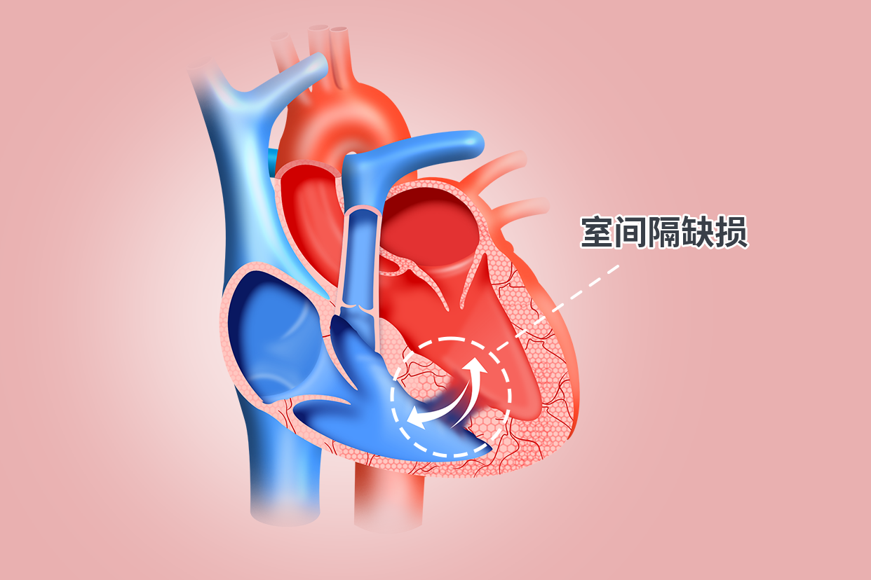 每日一题_2023.09.24