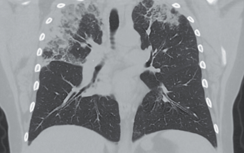 每日一题_2023.09.21