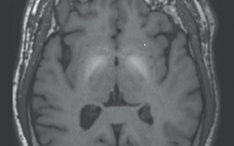 每日一题_2023.09.29