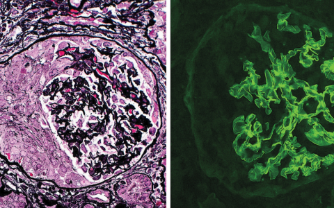 每日一题_2023.11.10