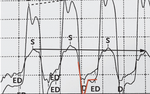 每日一题_2023.11.24