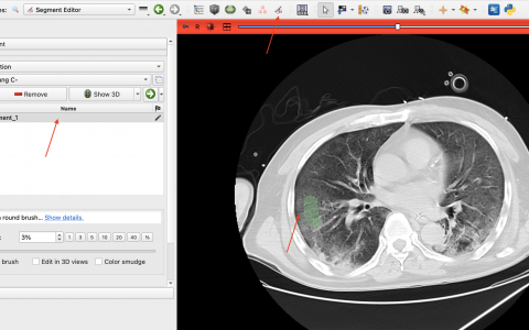 使用3D Slicer来获取ROI（掩膜）