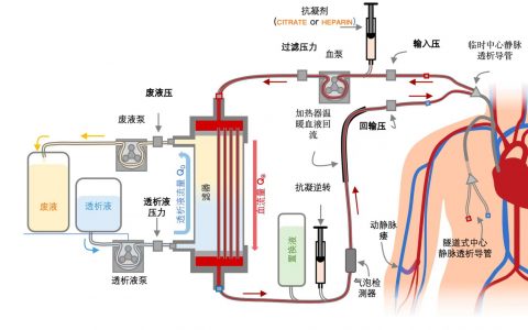 ICUOnePage:肾脏替代治疗