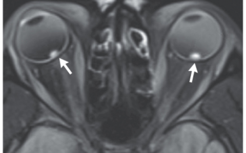 每日一题_2023.12.21