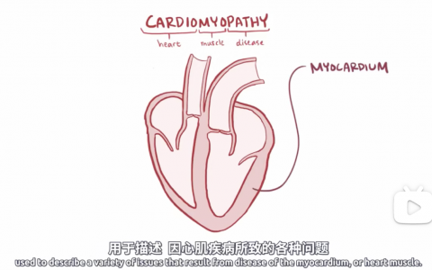 【Osmosis】：扩张型心肌病 