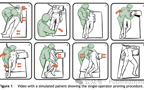 ICU中单人操作患者俯卧位