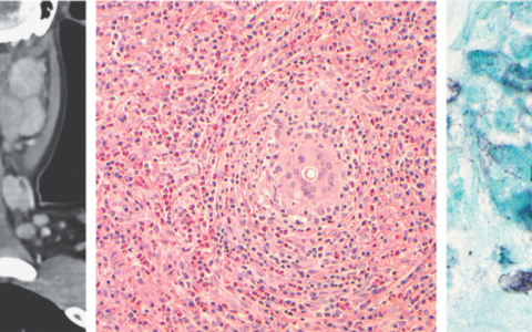 每日一题_2024.01.18