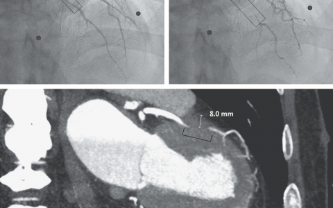每日一题_2023.01.25