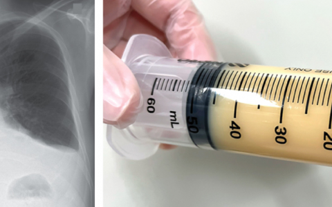 每日一题_2024.02.15