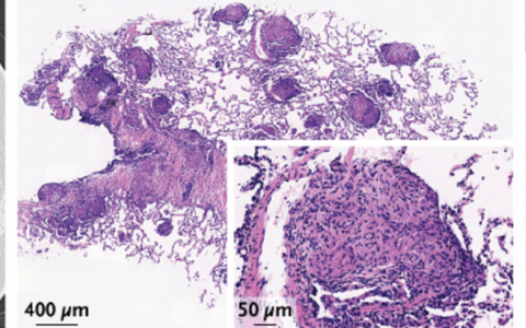 每日一题_2024.02.22