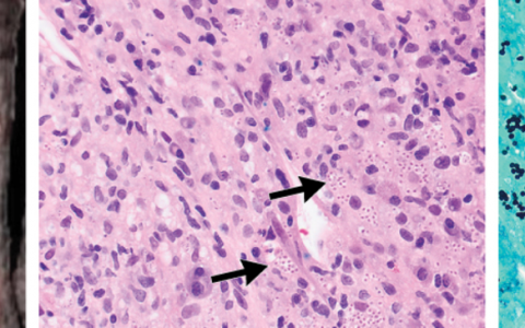 每日一题_2024.03.14