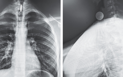 每日一题_2024.03.22