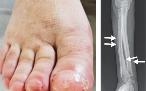 每日一题_2024.03.29