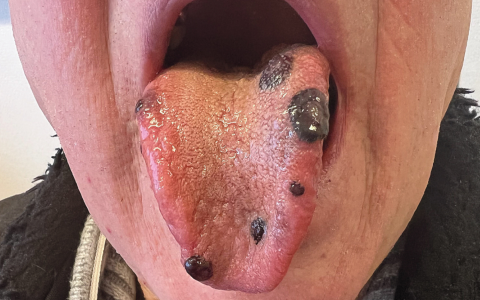 每日一题——2024.03.08