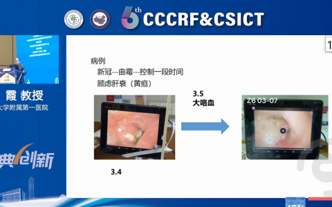 哪些患者需要抗真菌治疗_浙一郑霞