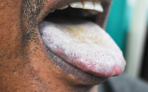 每日一题_2024.04.05