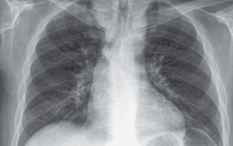 每日一题_2024.04.12