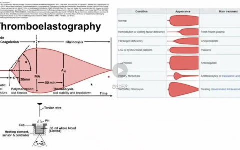 血栓弹力图（TEG）知识