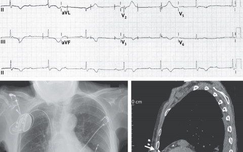 每日一题_2024.05.10