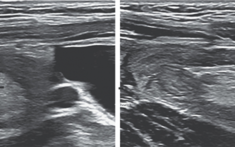 每日一题_2024.05.30