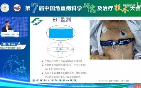 如何解读EIT图像