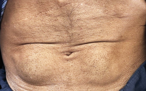 每日一题_2024.06.13