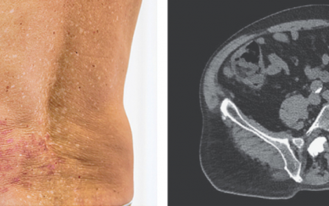 每日一题_2024.06.21