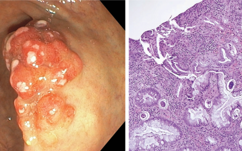 每日一题_20240704