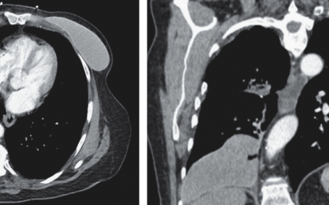 每日一题_2024.07.26