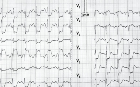 每日一题_2024.08.23