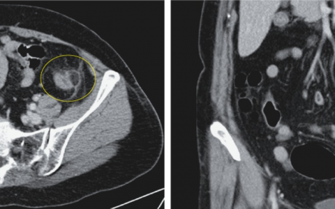 每日一题_2024.08.16