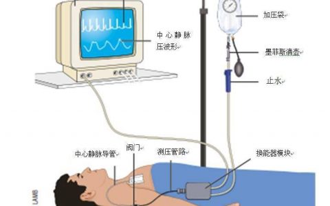你测量的CVP是mmHg还是cmH2O？