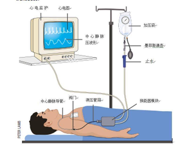 你测量的CVP是mmHg还是cmH2O？