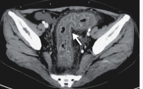 每日一题_2024.09.05