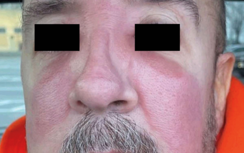 每日一题_2024.10.25