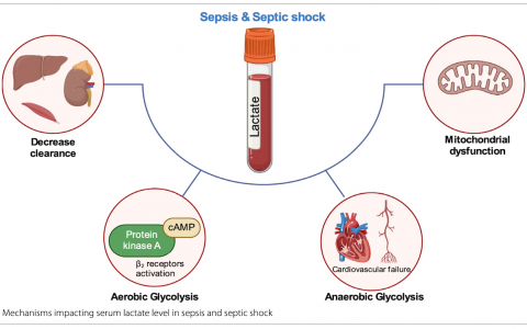 ICM:连续乳酸测量指导复苏：更多的证据不支持？