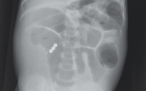 每日一题_2024.11.15