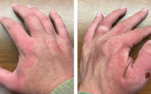 每日一题_2024.11.23