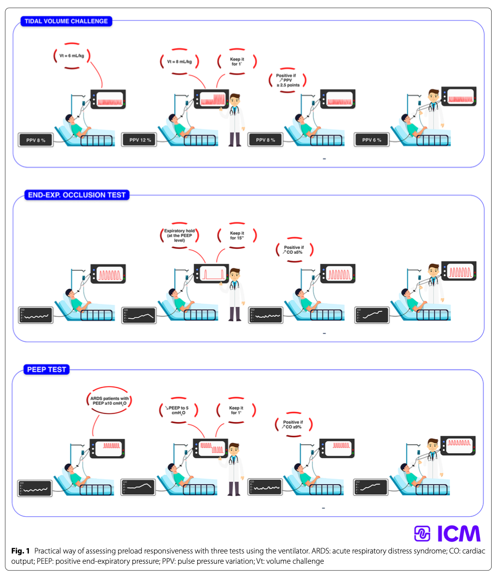 ICM:通过呼吸机预测液体反应性