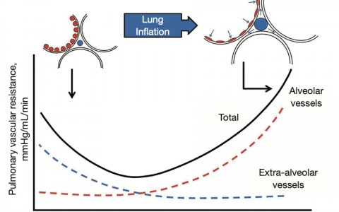 肺容积和肺血管阻力(PVR)之间的关系